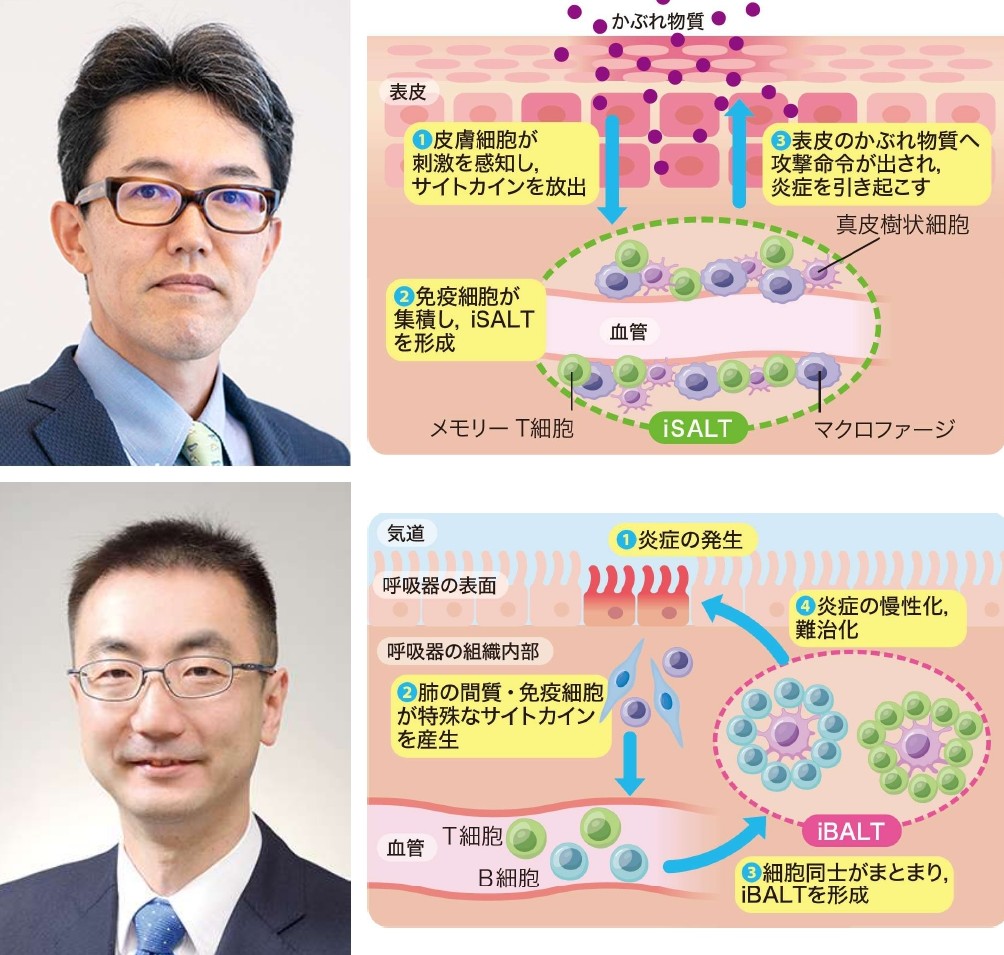 【寄稿】個別化医療の実現に挑む（椛島健治，平原潔）
