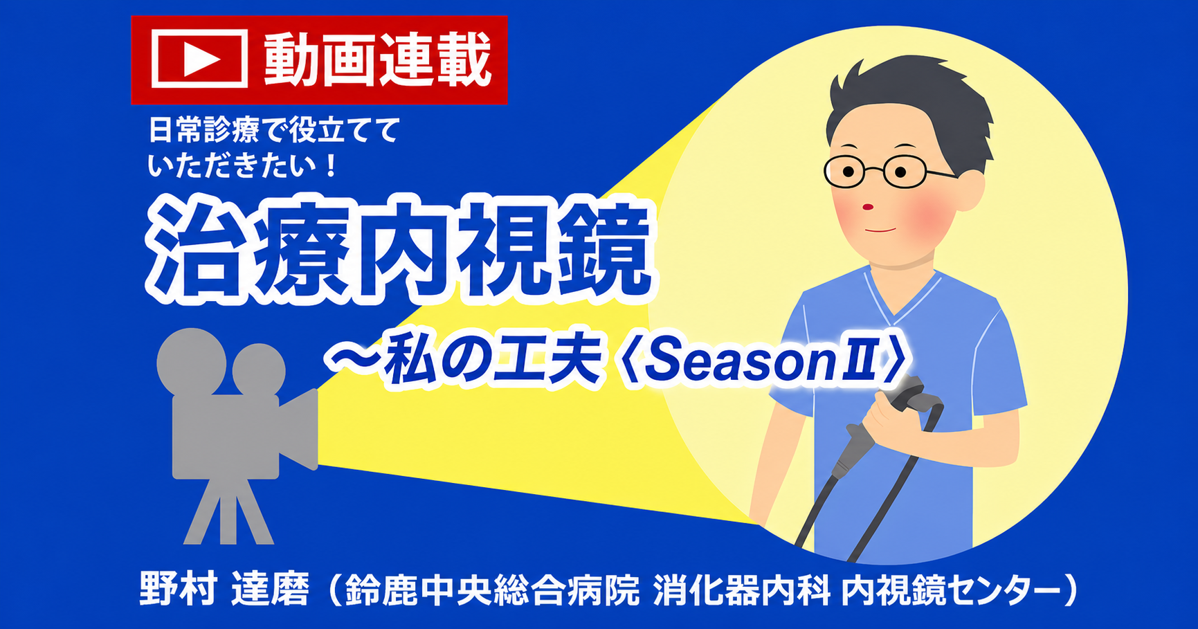 【ウェビナーで供覧した動画と同一の動画となります】第3回　S状結腸の80mm大のIs病変に対するunderwater ESD/Flow-Assisted Coagulation(FAC) using Gas-free immersion(GFI) system 野村達磨（鈴鹿中央総合病院 消化器内科 内視鏡センター）