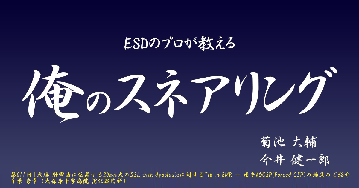 第011回 [大腸]肝彎曲に位置する20mm大のSSL with dysplasiaに対するTip in EMR ＋ 用手的CSP(Forced CSP)の論文のご紹介 千葉 秀幸（大森赤十字病院 消化器内科）