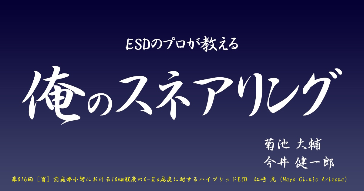 第016回 [胃] 前庭部小彎における10mm程度の0-Ⅱa病変に対するハイブリッドESD　江崎 充（Mayo Clinic Arizona）