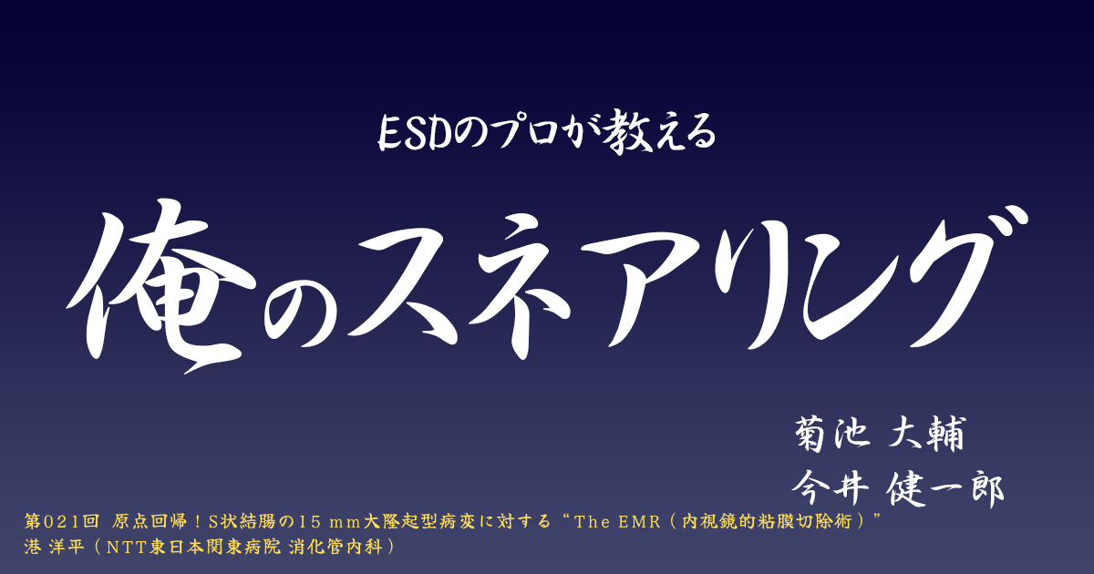 ESDのプロが教える「俺のスネアリング」 第021回［大腸］原点回帰！S状結腸の15 mm大隆起型病変に対する “The EMR（内視鏡的粘膜切除術）” 港 洋平（NTT東日本関東病院 消化管内科）